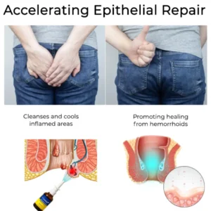 Herbal Hemorrhoid Treatment Anal Spray - Image 3