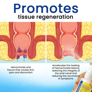 Herbal Hemorrhoids Fast-Acting Treatment Spray - Image 4