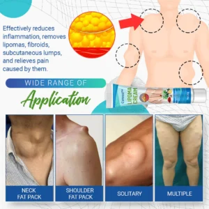 Cvreoz Lipoma Removal Cream - Image 8