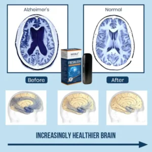 FreshLoom Cognitive Regeneration Inhaler - Image 5