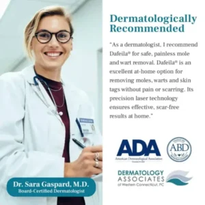 DAFEILA® LumeSkin Mole and Wart Removal Laser Pen - Image 5