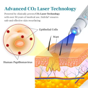 LumeSkin Mole and Wart Removal Laser Pen - Image 5