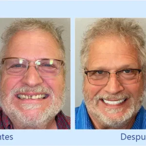 - Prótesis Dental Premium - Image 10