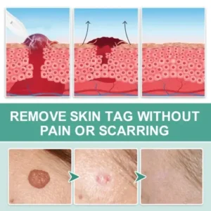 Advanced Plasma Laser Spot Cleaning Pen - Image 6
