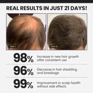 FollicleBoost 5X Hair Growth Serum - Image 5