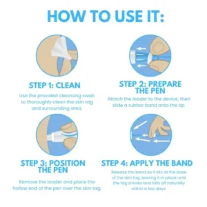 Skin Tag Removal Pen - Image 7