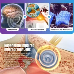 Dafeila™ SoniPulse Tinnitus Relief Soothing Aid - Image 4