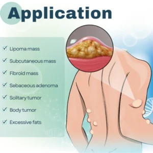 Lipoma Removal Cream - Image 6
