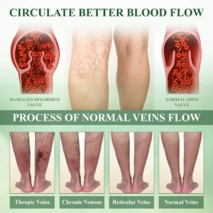 Advanced SwellCare Lymphatic Cream - Image 11