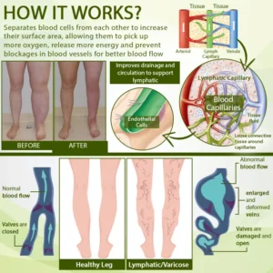 Advanced SwellCare Lymphatic Cream - Image 7