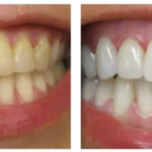 Niacinamide Intensive Whitening Toothpaste - Image 7