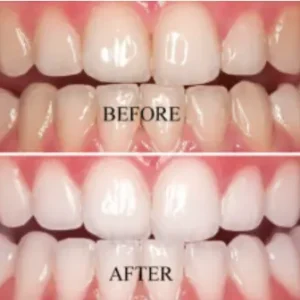 Niacinamide Intensive Whitening Toothpaste - Image 8
