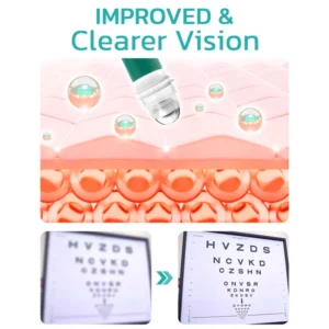 OphthlaMed Vision Enhance Roller - Image 3