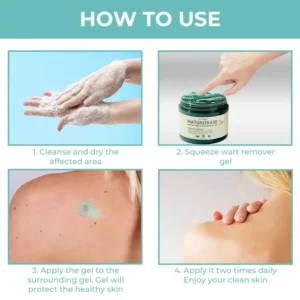 NatureErase Instant Mole & Spot Removal Gel - Image 2