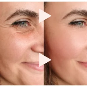 The Express Anti-Wrinkle - Image 3