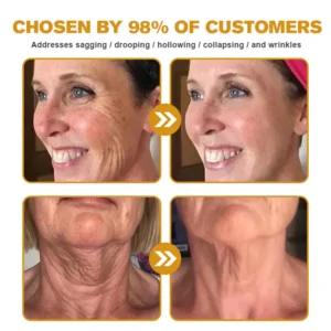 Bee Poison Skin Restoration Cream - Image 2