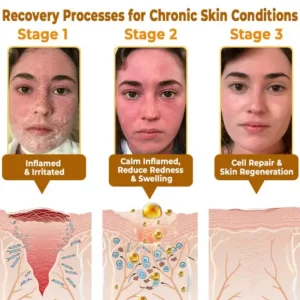 Bee Poison Skin Restoration Cream - Image 8