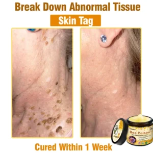 Bee Poison Skin Restoration Cream - Image 6