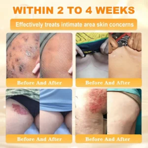 Bee Venom Skin Restoration Cream - Image 10