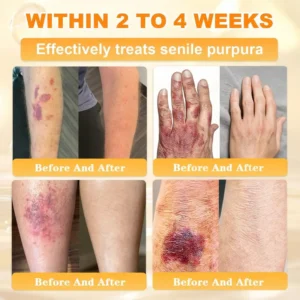 Bee Venom Skin Restoration Cream - Image 8