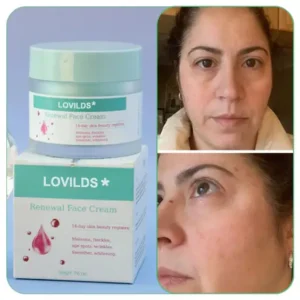 Renewal Skin Cream - Image 4