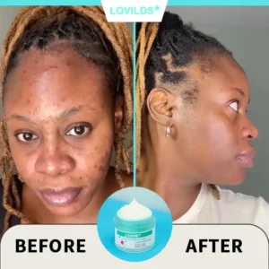 Renewal Skin Cream - Image 8