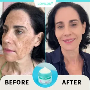 Renewal Skin Cream - Image 9