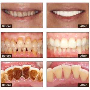 Niacinamide Whitening Toothpaste - Image 3