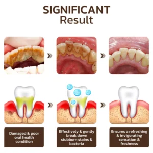 Niacinamide Whitening Toothpaste - Image 5