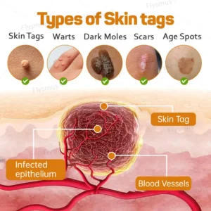 Tag Recede Bee Venom Treatment Cream - Image 4