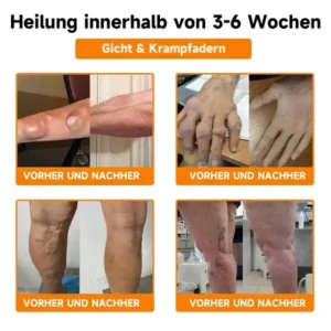 Bienengift- und Kurkuma-Gelenk- und Knochenschmerzlinderungscreme - Image 16
