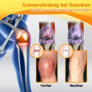 Bienengift- und Kurkuma-Gelenk- und Knochenschmerzlinderungscreme - Image 6