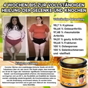 Bienengift- und Kurkuma-Gelenk- und Knochenschmerzlinderungscreme - Image 8