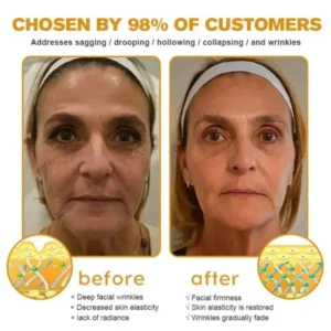 Botox Bee Venom Wrinkle Remover Cream - Image 4