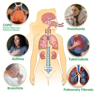Lung Mucus Cleansing Inhaler - Image 3