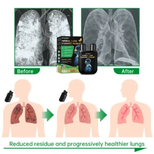 Lung Mucus Cleansing Inhaler - Image 6