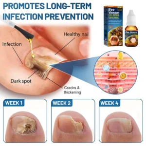 Bee Venom Nail Repair Treatment - Image 5