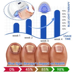 PureNail Fungus Laser Therapy Device - Image 4