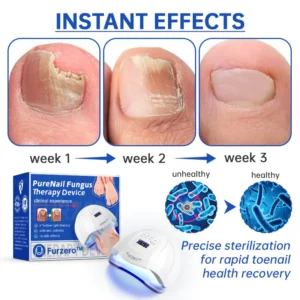PureNail Fungus Laser Therapy Device - Image 6