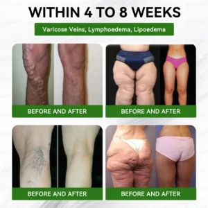 8-𝒊𝒏-1 𝙁𝙞𝙩 &b𝙑𝙞𝙩𝙖𝙡 𝖮𝗋𝖺𝗅 𝙎𝙤𝙡𝙪𝙩𝙞𝙤𝙣 𝐰𝐢𝐭𝐡 𝐌𝐨𝐫𝐢𝐧𝐠𝐚 𝐎𝐦𝐞𝐠𝐚-𝟑 𝐂𝐨𝐥𝐥𝐚𝐠𝐞𝐧 𝐏𝐞𝐩𝐭𝐢𝐝𝐞𝐬 𝐍𝐀𝐃 &𝐍𝐌𝐍 - Image 8