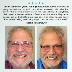 Advanced Customized Full Denture Set - Image 4