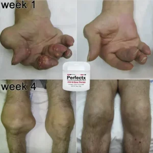 Perfectx Joint And Bone Therapy Cream - Image 4