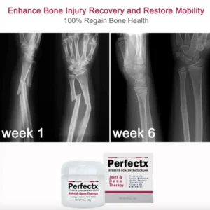 Perfectx Joint And Bone Therapy Cream - Image 5