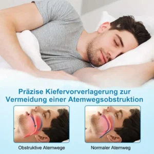 Anti-Schnarch- und Anti-Schleif-Zahnschutz - Image 7