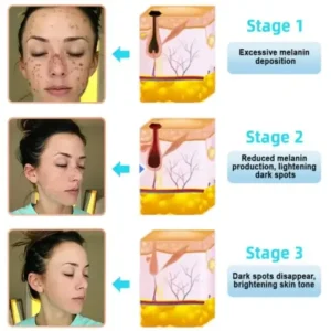 Exfoliating Cream for Dark Spots & Firmer Skin - Image 12