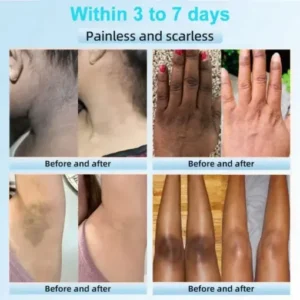 Exfoliating Cream for Dark Spots & Firmer Skin - Image 2