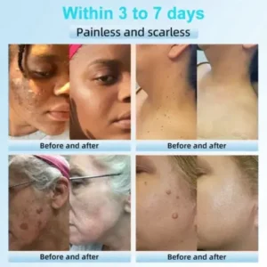 Exfoliating Cream for Dark Spots & Firmer Skin - Image 3