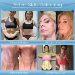 Anti-Wrinkle Skin Cream - Image 3