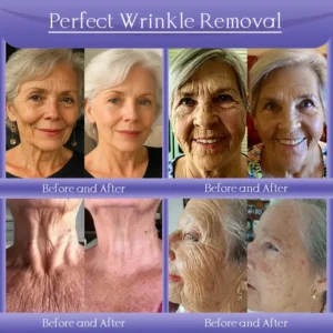 Anti-Wrinkle Skin Cream for Remove Wrinkles - Image 2
