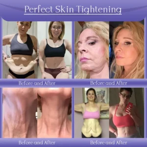 Anti-Wrinkle Skin Cream for Remove Wrinkles - Image 3